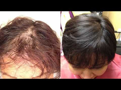 Rise UP - Scalp Treatment